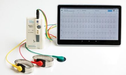 Egy AI-alapú hazai fejlesztés teszi gyorsabbá a mobil EKG felvételek kiértékelését